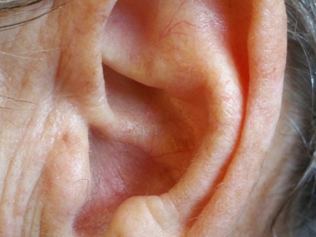 Seelsorge für Menschen, die nicht alles hören und nicht alles verstehen